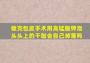 做完包皮手术用高锰酸钾泡头头上的干珈会自己掉落吗